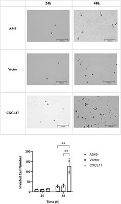 Overexpression of CXCL17 increases migration and invasion of A549 lung adenocarcinoma cells